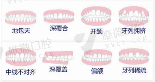 种植牙覆盖义齿（种植牙过渡义齿）(图1)